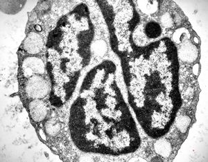 M,18y. | blood - basophilic granulocyte M,18y. | blood - basophilic granulocyte